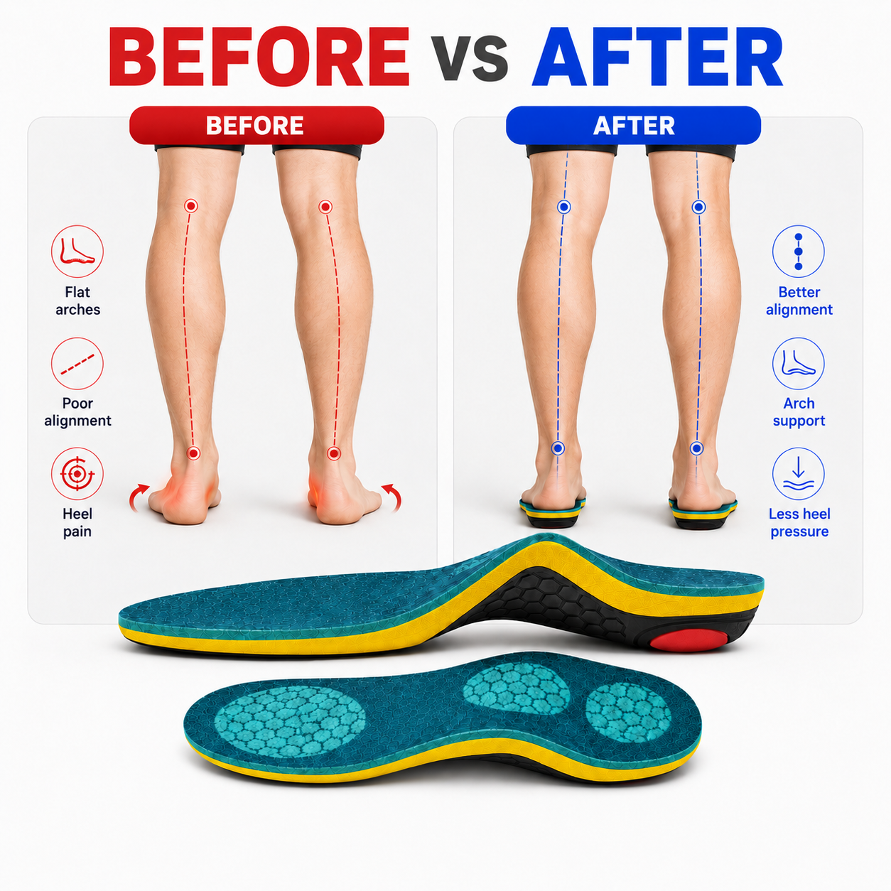Suthe™ — StepAlign Insoles