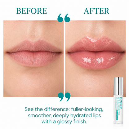 Suthe™ – Korean BP Volumizing Lip Shot